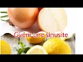 Lagu Sinusite : astuce naturelle pour traiter la sinusite