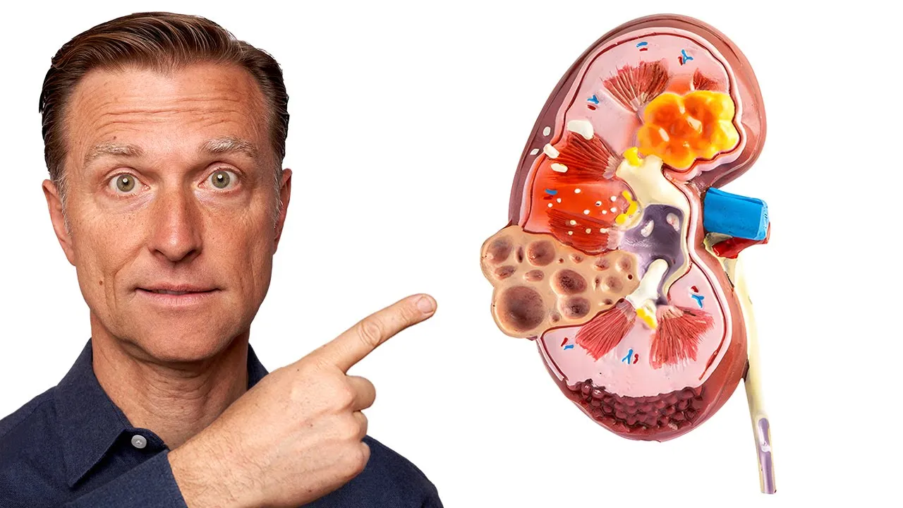Outline Video The TOP Best Foods to Improve Kidney Function (END STAGE KIDNEY DISEASE)
