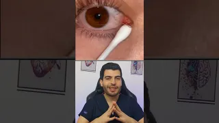 صحة العين  متلازمة الصيد المخاطي   العين  التهاب  التهاب العين  صحة العين  د مصعب حسوا  يوتيوب دندنها