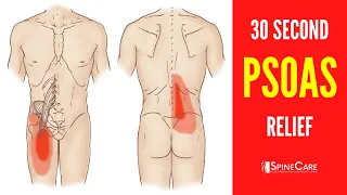 Download How to Fix a Tight Psoas Muscle in 30 SECONDS MP3