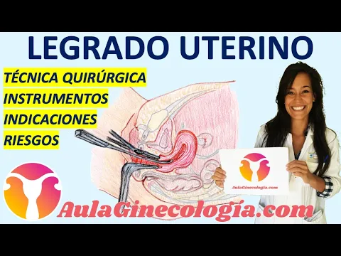 Download MP3 LEGRADO UTERINO: TÉCNICA QUIRÚRGICA, INSTRUMENTOS, RIESGOS... - Ginecología y Obstetricia -