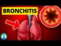 Bronchitis Medical Definition Quick Explainer