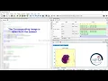 PYTHON 2021 Project - Types Of Blood Cell Classification Using Local Binary Pattern