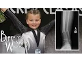 Blakely s First Gymnastics Meet after Broken Leg Blakely