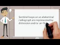 What are sentinel loops