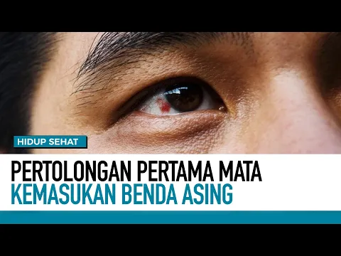 Pertolongan Pertama Mata Kemasukan Benda Asing
