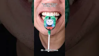 ASMR Thomas Train Chocolate Lollipop Doctortristanpeh Asmr Lollipop 