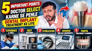 Dental Implant Karane Se Pehle Doctor Select Karne Ke 5 Important Points | Implant Treatment Guide