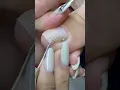 Download Lagu #satisfying #nails #nailcare #howtodoyournailsathome #grooming #selfcare #ingrowntoenail #cleaning