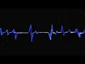 Download Lagu RudyWade \u0026 LeGrand - Heartbeat [Animated Lyric Video]