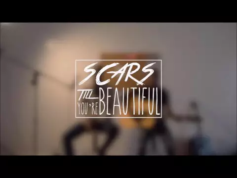 Download MP3 Alessia Cara - Scars to Your Beautiful (mp3 download)