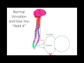 How Does Spinal Cord Injury Effect the Bladder