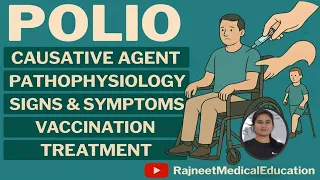 Polio | Causes | Pathophysiology | Sign & Symptoms | Vaccination | Treatment