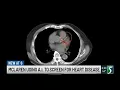 McLaren using A I to screen for heart disease