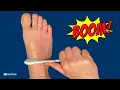 Download Lagu How to Relieve Foot Pain in 30 SECONDS