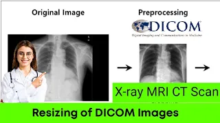 How to resize the DICOM images Preprocessing Processing X ray MRI CT Scan ITFO
