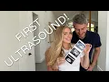 Download Lagu FINDING OUT IF WE ARE HAVING TWINS AGAIN! First ultrasound