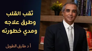 ثقب القلب ما هو وطريقة علاجه ومدي خطورته أ د طارق الطويل 