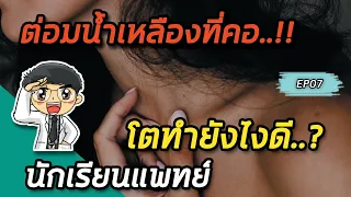 ต่อมน้ำเหลืองโตแบบทั่วร่างกายพร้อมน้ำหนักลดและมีไข้ ควรพิจารณาโรคใดเป็นอันดับแรก?