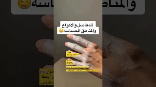 افضل كريم تبييض للعرايس و المناطق الحساسه هوا كريم كنتا 