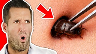 It Crawled WHERE?!