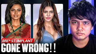 this plastic queen is done sherlyn chopra