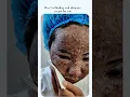 Download Lagu Day 1: Finding the Perfect Skincare Recipe for Radiant Skin #brightskin #glowup #glownaturally