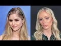 Celebrities Plastic Surgery Nightmares From Gorgeous to Ghastly