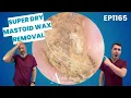 Extreme Dry Skin Ear Wax in Mastoid Cavity Cleared - EP1165