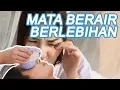 Download Lagu Mata Berair Berlebihan, Mengapa Bisa Terjadi?