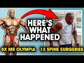Ronnie Coleman Mr 8x Olympia to 13 Spine Sugeries Here s what happened