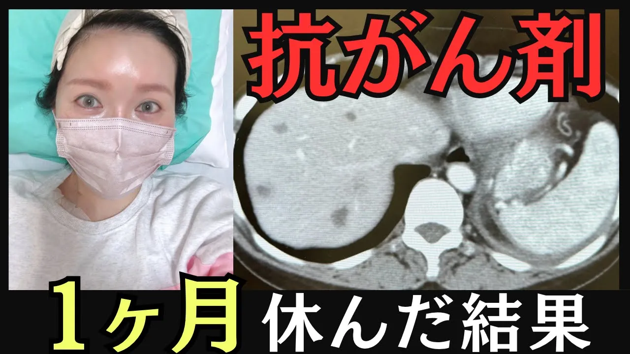 【乳がん末期】副作用で1ヶ月ダウン後の検査結果&抗がん剤変化の話し