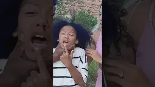 His Nose Started Doing This And Then The Unexpected Happened Shorts Eviltwin Mimic Chaos 