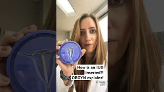 How is an IUD inserted OBGYN explains