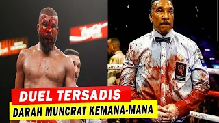 Download RE- Darah Muncrat Kemanamana 🥊🥊 Inilah DUEL TERSADIS Dalam Sejarah Tinju MP3