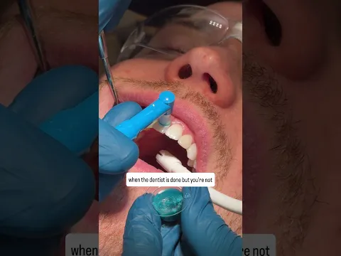 when that dental toothpaste hits too hard