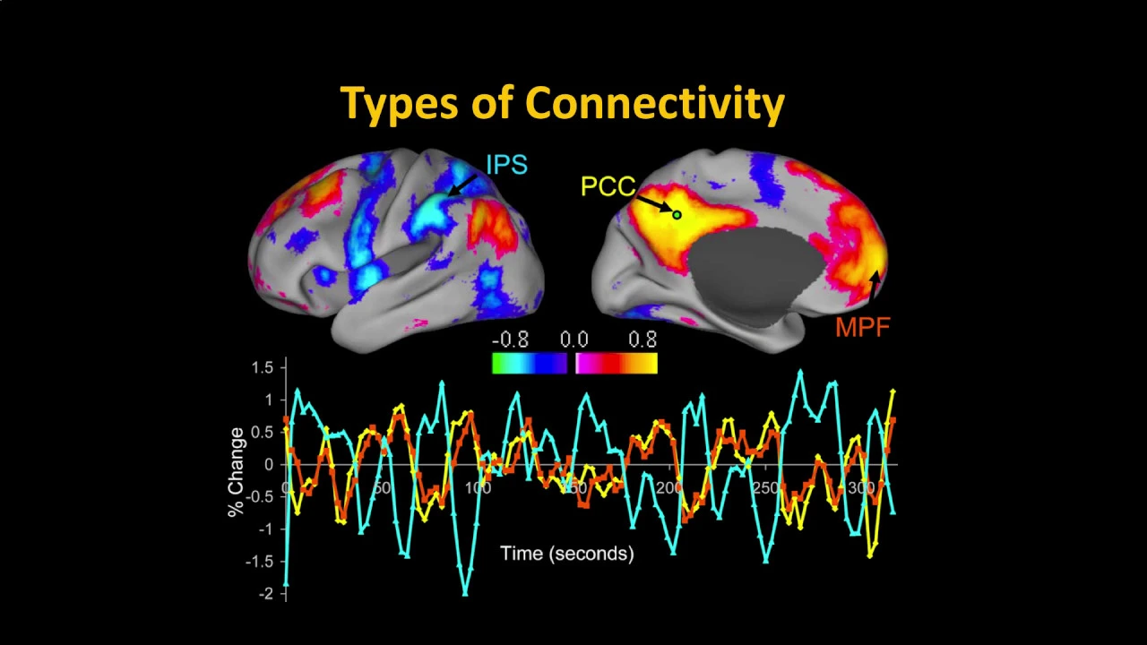 UMass Amherst CONN Workshop, Part 1: Functional Connectivity