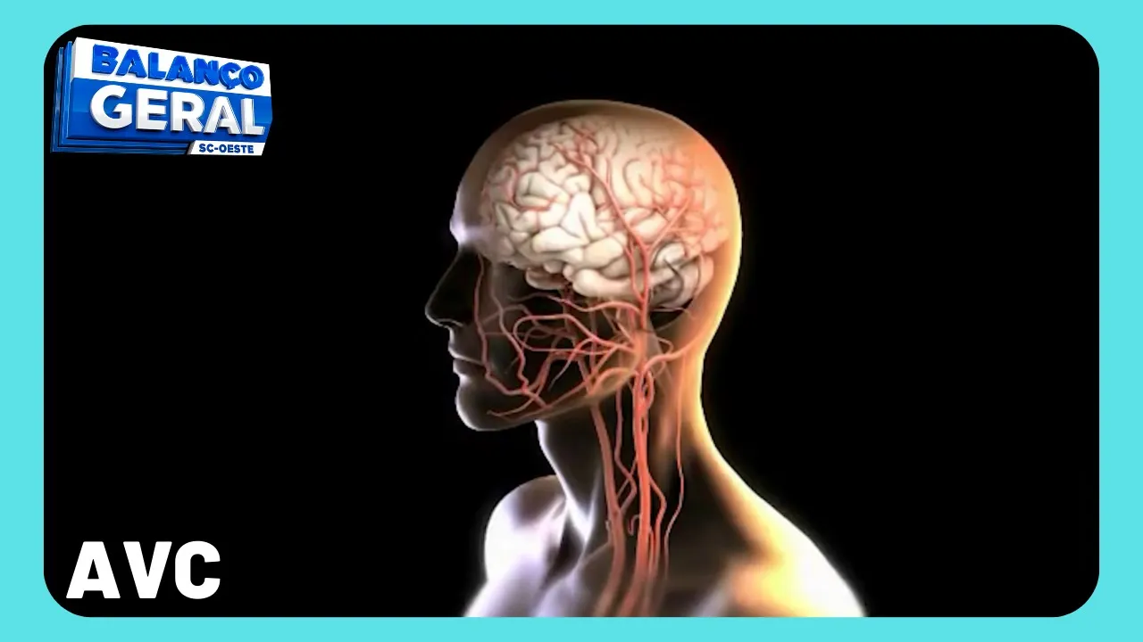 Dois hospitais de Chapecó recebem certificação por atendimento rápido em AVC