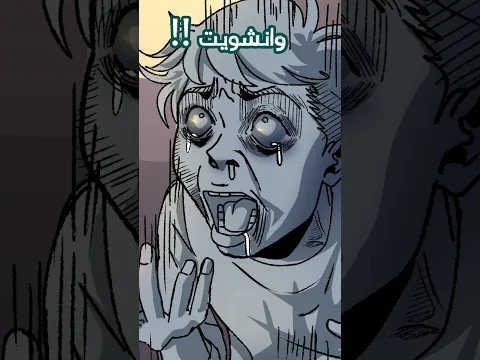 كان رح ينقطع اصبعي 😨 🔥