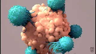 Mayo Clinic Minute - New approaches bring progress in treating multiple myeloma