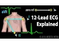 12 Lead ECG Explained Animation