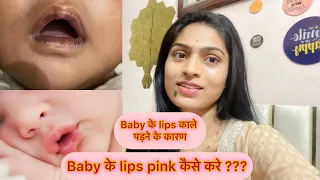 Download ￼How to make baby lips pink ॥ Tips to make baby lips pink ॥ Baby lips के काले पड़ने के कारण MP3