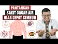 Download Lagu PANTANGAN CACAR AIR AGAR CEPAT SEMBUH DAN TIDAK MEMBERAT - DOKTER SADDAM ISMAIL