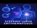 Systemic Lupus Erythematosus