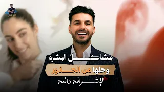 د كريم علي مشاكل البشرة وحلها من الجذور لإشراقة دائمة 