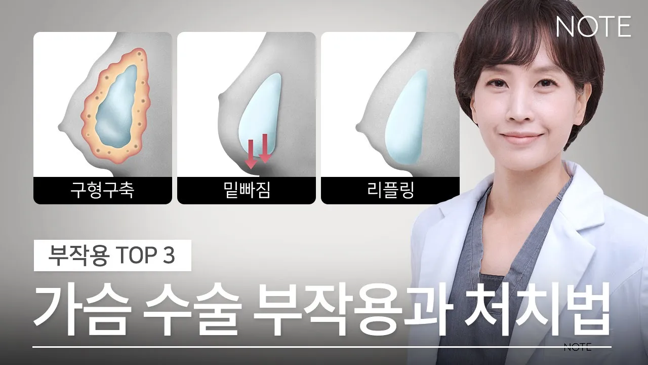 [가슴수술과 부작용] 가슴 수술 후 많이 생기는 부작용 l 발생 원인 l 자가진단법 l 처치 방법