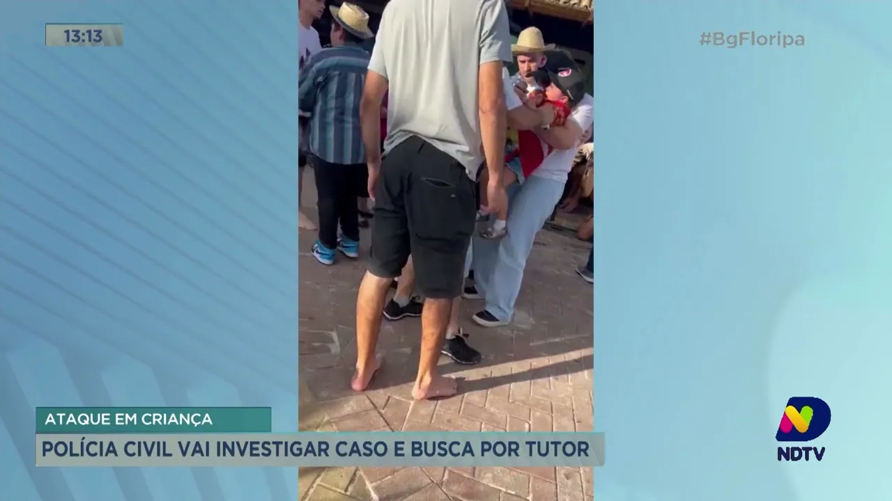 Polícia Civil vai investigar caso de criança atacada por cachorro e busca por tutor do animal