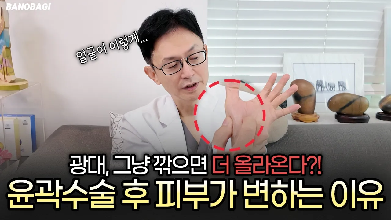 윤곽수술 후 처짐 방지 노하우 공개...⁉️ 원장님의 솔직한 QnA 2탄💥