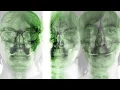 Supergrass - Moving (Official Audio)