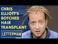 Download Lagu De mislukte haartransplantatie van Chris Elliott | David Letterman
